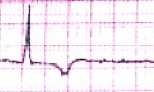 Гипертрофия левого желудочка сердца, что это и как можно лечить?